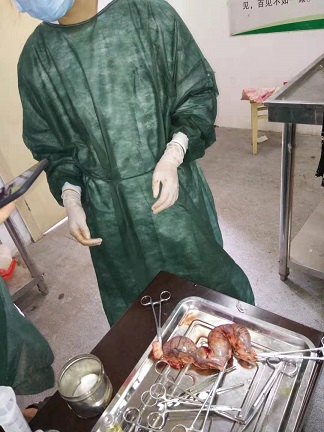 子宫蓄脓手术完成